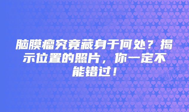 脑膜瘤究竟藏身于何处？揭示位置的照片，你一定不能错过！