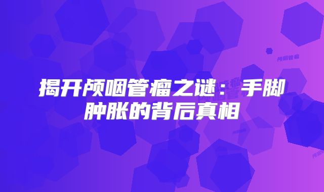揭开颅咽管瘤之谜：手脚肿胀的背后真相