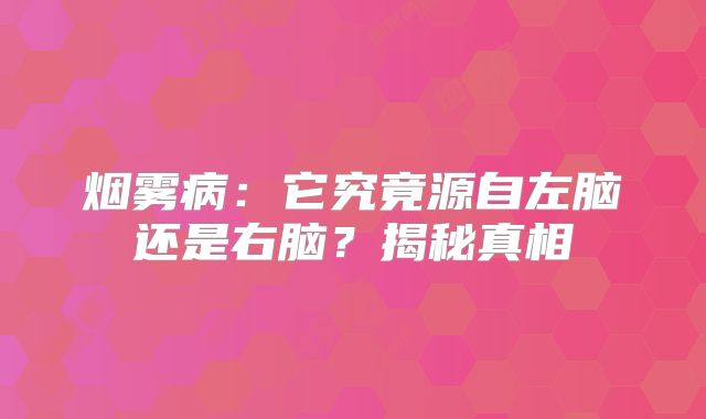 烟雾病：它究竟源自左脑还是右脑？揭秘真相