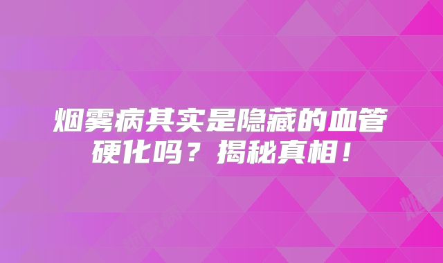 烟雾病其实是隐藏的血管硬化吗？揭秘真相！