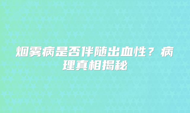 烟雾病是否伴随出血性？病理真相揭秘