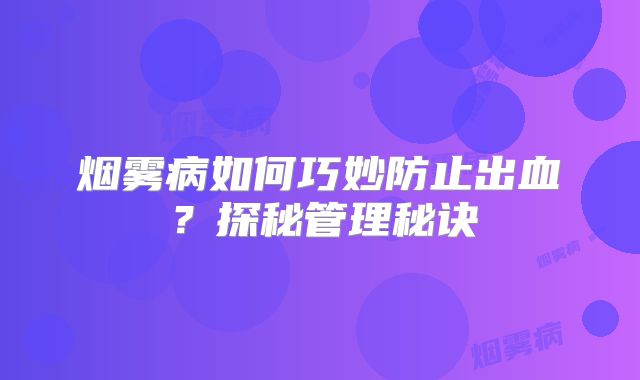 烟雾病如何巧妙防止出血？探秘管理秘诀