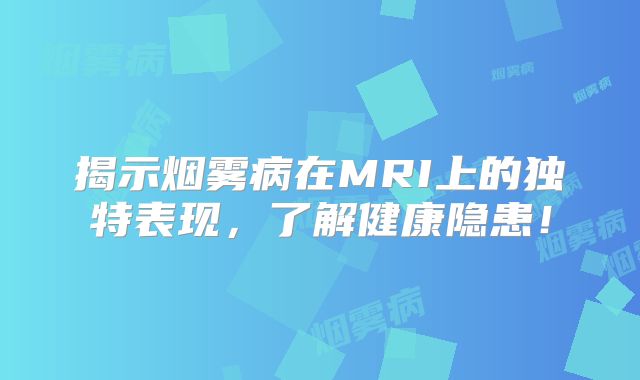 揭示烟雾病在MRI上的独特表现，了解健康隐患！