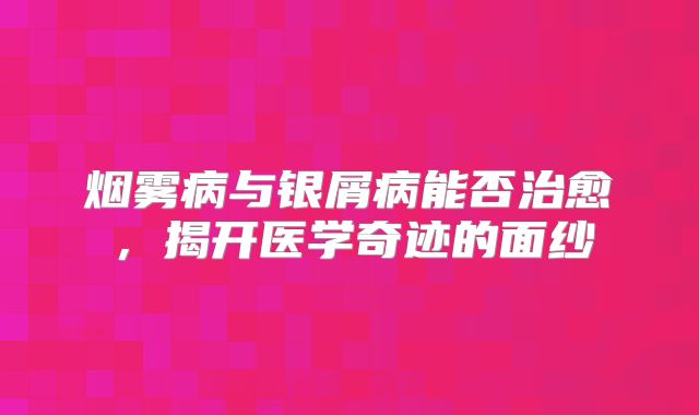 烟雾病与银屑病能否治愈，揭开医学奇迹的面纱