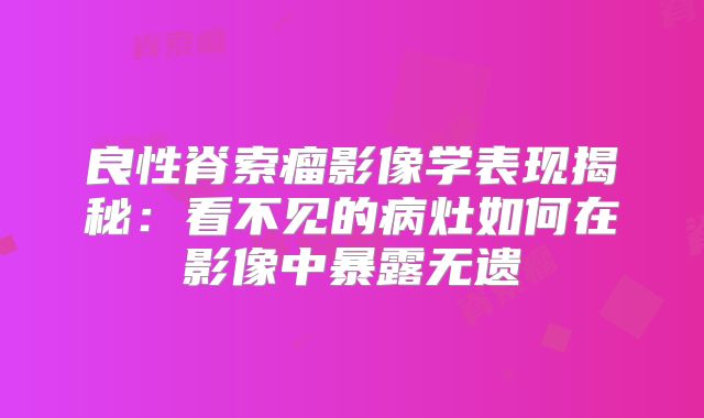 良性脊索瘤影像学表现揭秘：看不见的病灶如何在影像中暴露无遗
