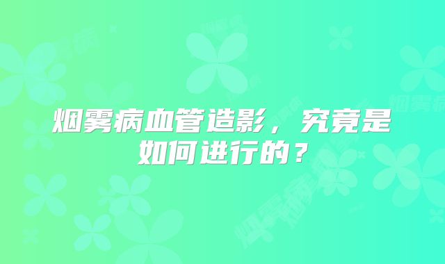 烟雾病血管造影，究竟是如何进行的？