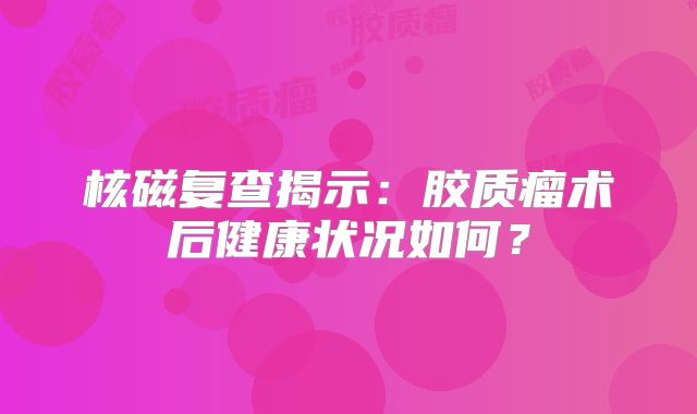 核磁复查揭示：胶质瘤术后健康状况如何？
