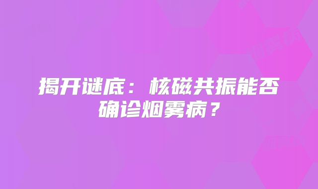 揭开谜底：核磁共振能否确诊烟雾病？