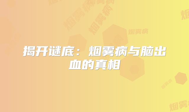 揭开谜底：烟雾病与脑出血的真相