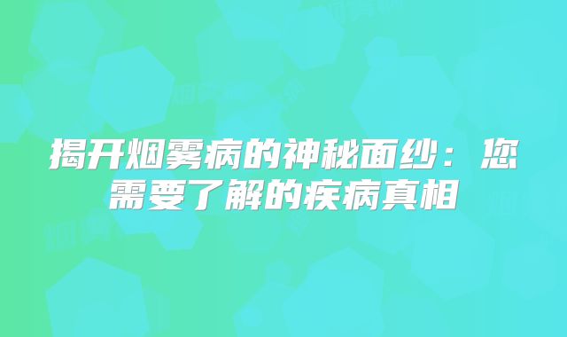 揭开烟雾病的神秘面纱：您需要了解的疾病真相