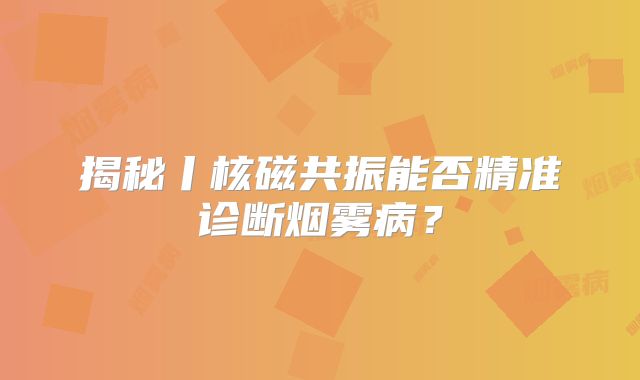 揭秘丨核磁共振能否精准诊断烟雾病？