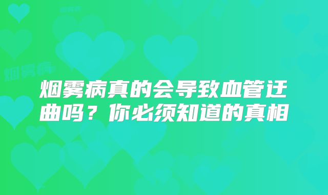 烟雾病真的会导致血管迂曲吗？你必须知道的真相