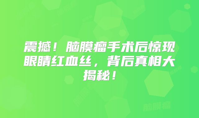 震撼！脑膜瘤手术后惊现眼睛红血丝，背后真相大揭秘！