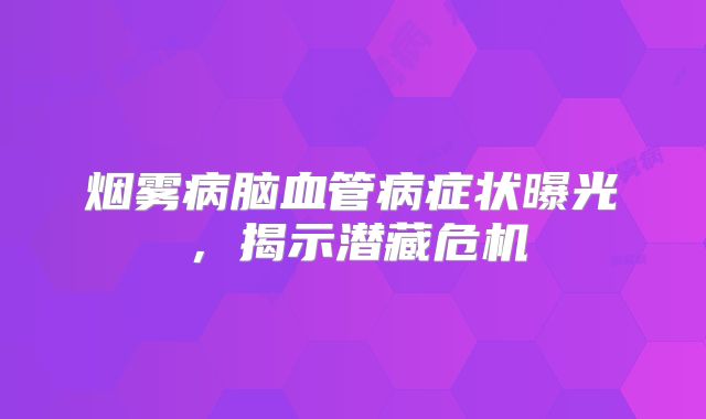 烟雾病脑血管病症状曝光，揭示潜藏危机