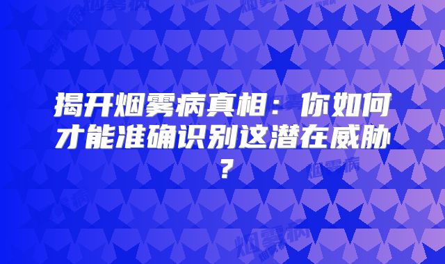 揭开烟雾病真相：你如何才能准确识别这潜在威胁？