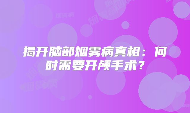 揭开脑部烟雾病真相：何时需要开颅手术？