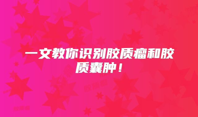 一文教你识别胶质瘤和胶质囊肿！