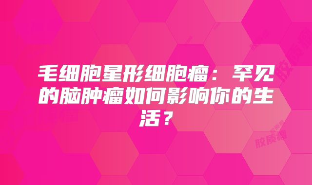 毛细胞星形细胞瘤：罕见的脑肿瘤如何影响你的生活？