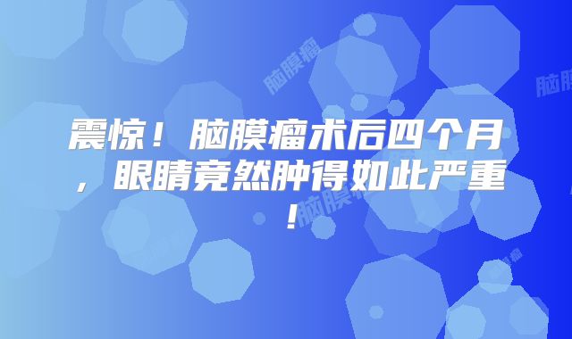 震惊！脑膜瘤术后四个月，眼睛竟然肿得如此严重！