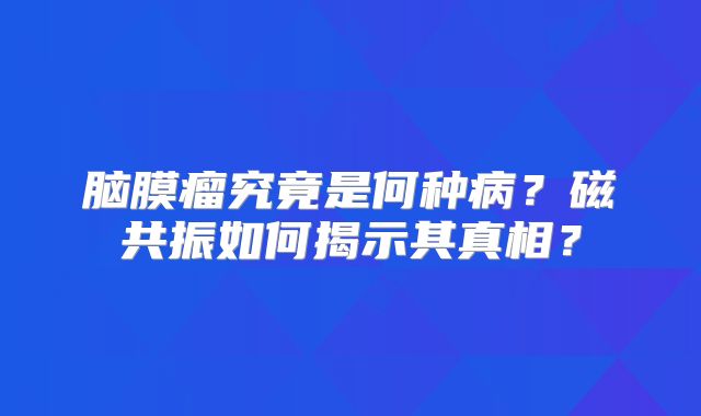 脑膜瘤究竟是何种病？磁共振如何揭示其真相？