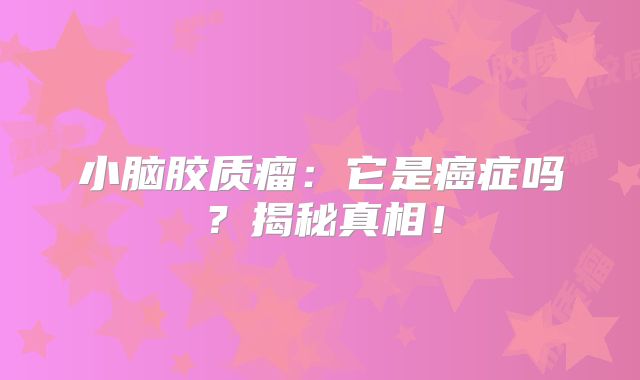 小脑胶质瘤：它是癌症吗？揭秘真相！
