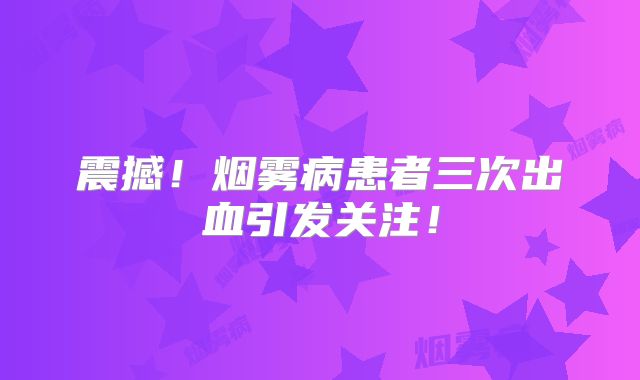 震撼！烟雾病患者三次出血引发关注！
