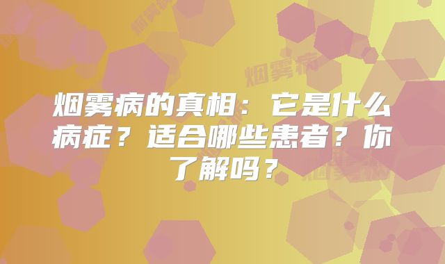 烟雾病的真相：它是什么病症？适合哪些患者？你了解吗？