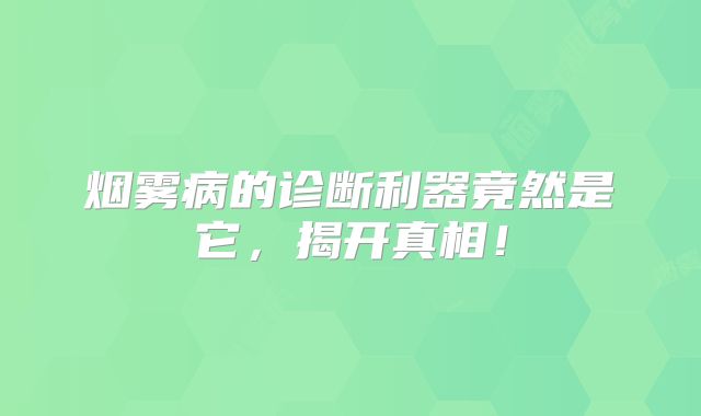 烟雾病的诊断利器竟然是它，揭开真相！