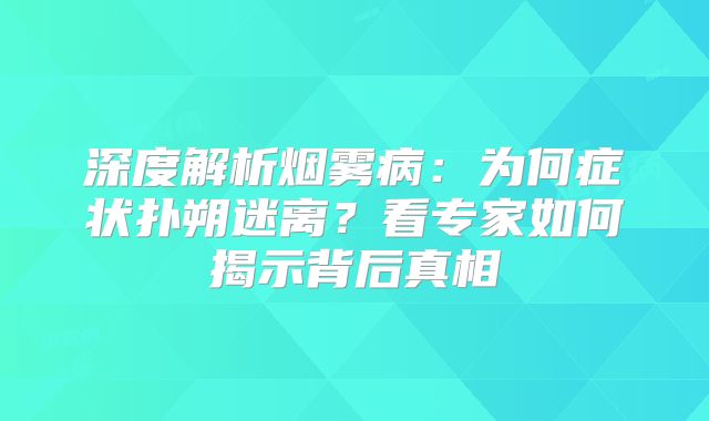 深度解析烟雾病：为何症状扑朔迷离？看专家如何揭示背后真相