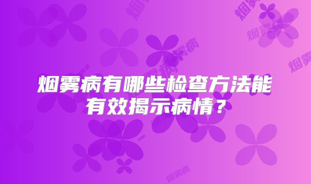 烟雾病有哪些检查方法能有效揭示病情？