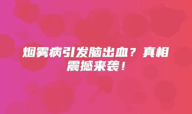 烟雾病引发脑出血？真相震撼来袭！