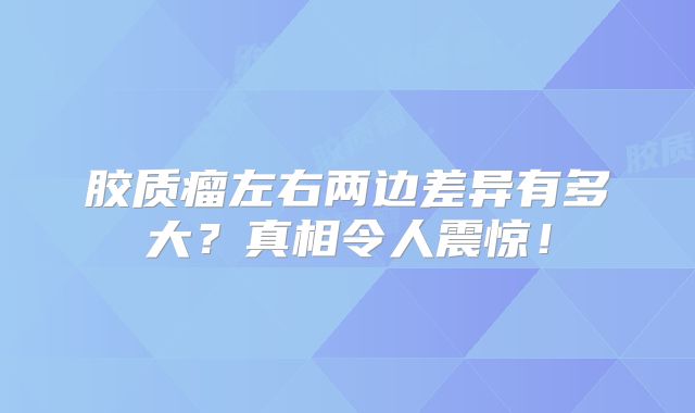 胶质瘤左右两边差异有多大？真相令人震惊！