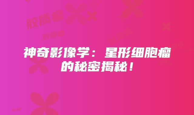 神奇影像学：星形细胞瘤的秘密揭秘！