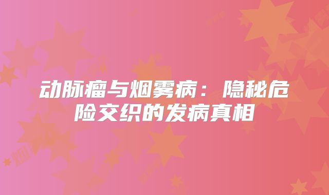 动脉瘤与烟雾病：隐秘危险交织的发病真相