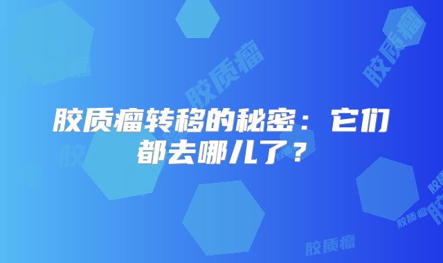 胶质瘤转移的秘密：它们都去哪儿了？