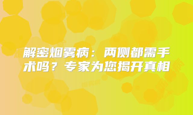 解密烟雾病：两侧都需手术吗？专家为您揭开真相