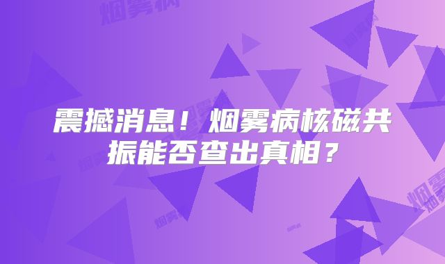 震撼消息！烟雾病核磁共振能否查出真相？