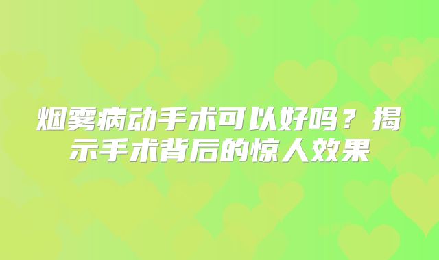 烟雾病动手术可以好吗？揭示手术背后的惊人效果