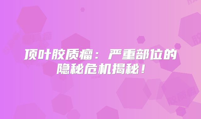 顶叶胶质瘤：严重部位的隐秘危机揭秘！
