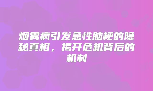 烟雾病引发急性脑梗的隐秘真相，揭开危机背后的机制
