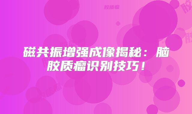 磁共振增强成像揭秘：脑胶质瘤识别技巧！