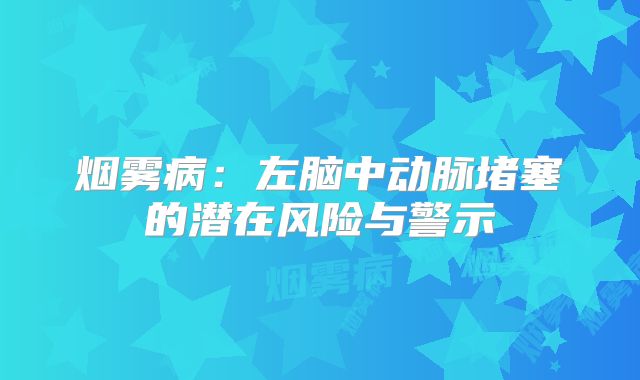 烟雾病：左脑中动脉堵塞的潜在风险与警示