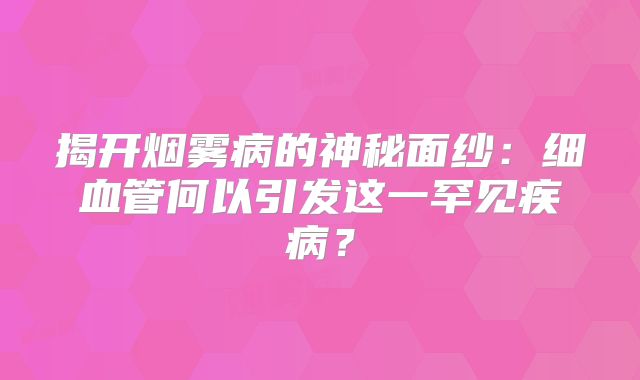 揭开烟雾病的神秘面纱：细血管何以引发这一罕见疾病？