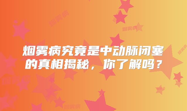 烟雾病究竟是中动脉闭塞的真相揭秘，你了解吗？