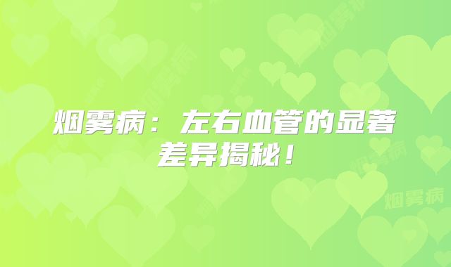烟雾病：左右血管的显著差异揭秘！