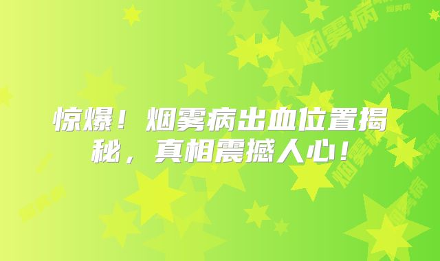 惊爆！烟雾病出血位置揭秘，真相震撼人心！