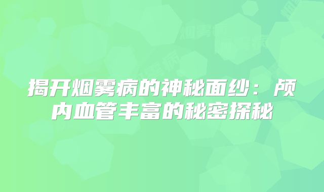 揭开烟雾病的神秘面纱：颅内血管丰富的秘密探秘