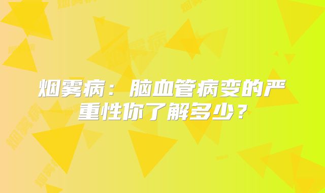 烟雾病：脑血管病变的严重性你了解多少？
