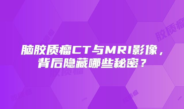 脑胶质瘤CT与MRI影像，背后隐藏哪些秘密？