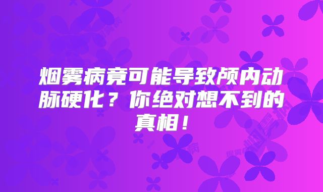 烟雾病竟可能导致颅内动脉硬化？你绝对想不到的真相！